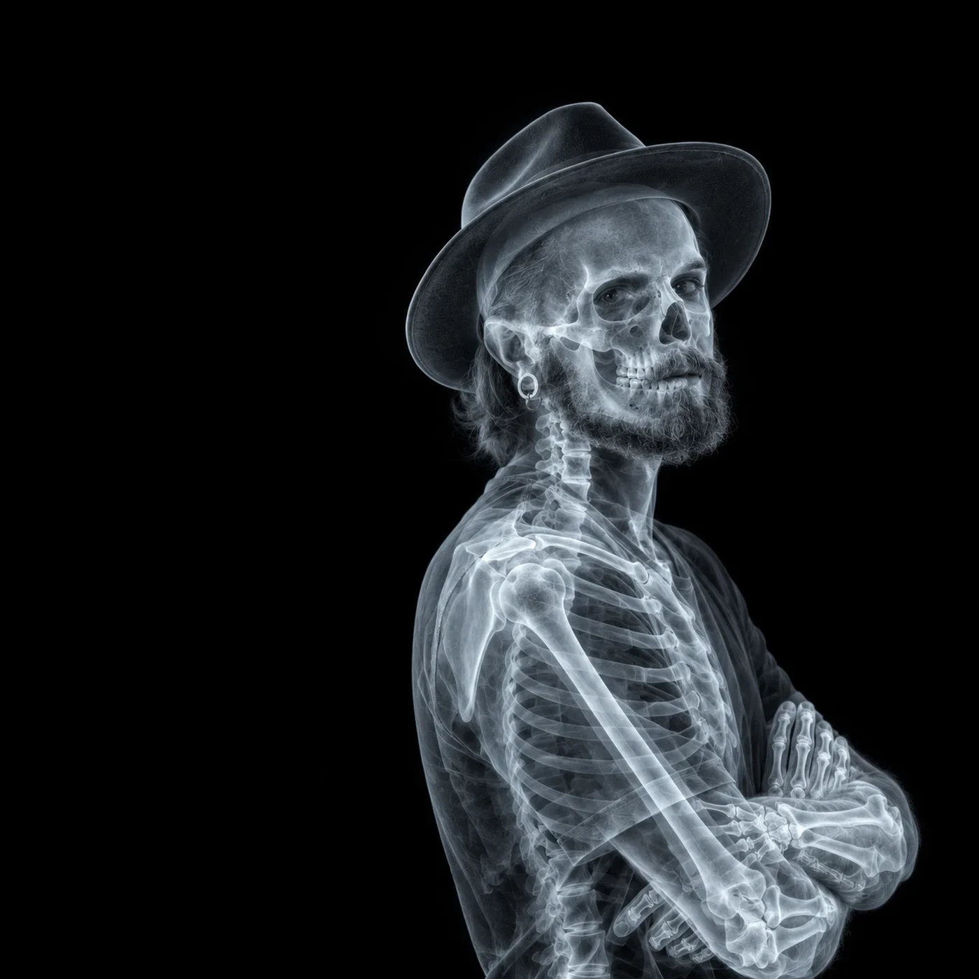 Joël Ferrari, aux rayons X